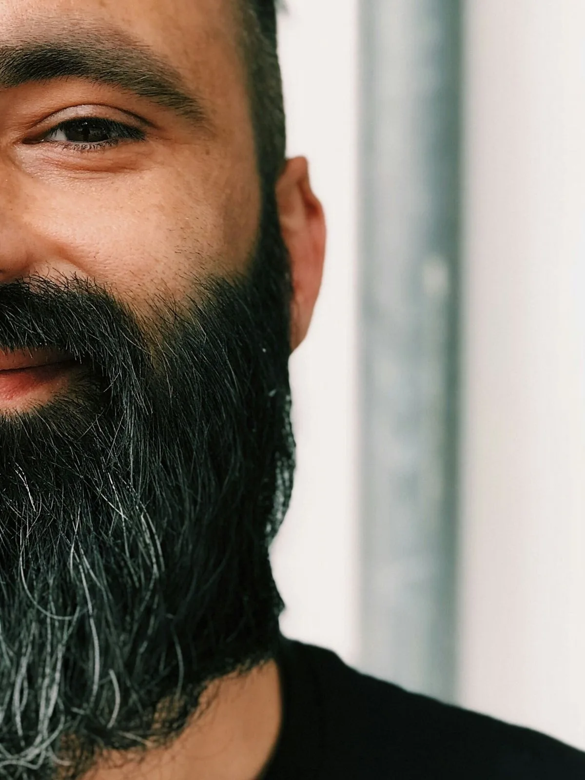 Transplante de Barba: Guia Completo de Técnicas, Resultados e Preços 2026